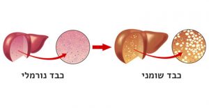 כבד שומני | בסט מדיקל - מרכז רפואי פרטי