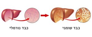 כבד שומני | בסט מדיקל - מרכז רפואי פרטי