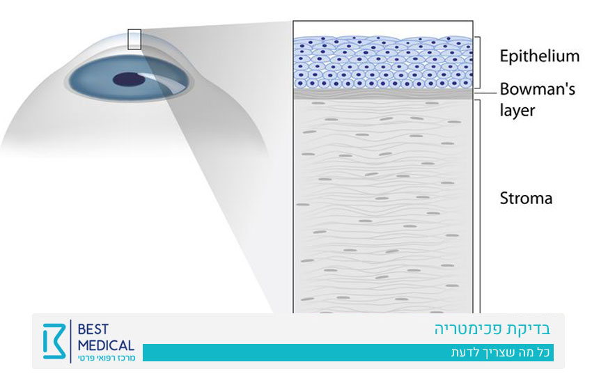 בדיקת עובי קרנית | בדיקת פכימטריה | מרכז רפואת עיניים בסט מדיקל 