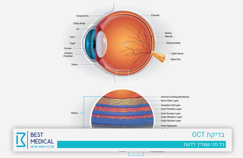 בדיקת OCT | בדיקת רשתית העין | מרכז רפואת עיניים בסט מדיקל 